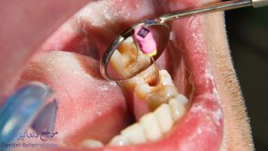 دندانپزشک متخصص عصب کشی دندان در شیراز به همراه آدرس و شماره تماس