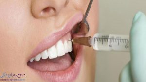 دندانپزشک متخصص کشیدن دندان در شیراز به همراه آدرس و شماره تماس