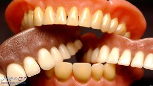 دندان مصنوعی شیراز | آدرس و شماره تماس بهترین متخصص پروتز دندان متحرک در شیراز