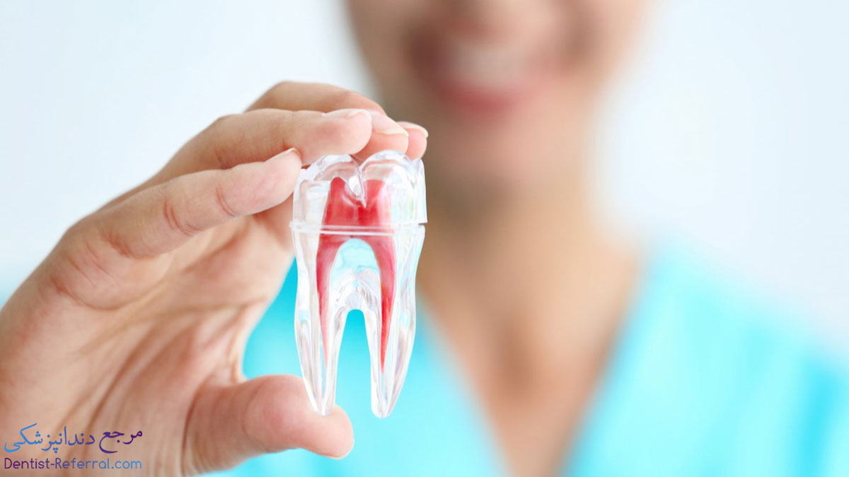 درمان ریشه دندان شیراز