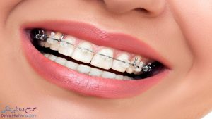 دندانپزشک متخصص ارتودنسی دندان در شیراز به همراه آدرس و شماره تماس