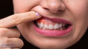دندانپزشک متخصص آبسه دندان در شیراز به همراه آدرس و شماره تماس
