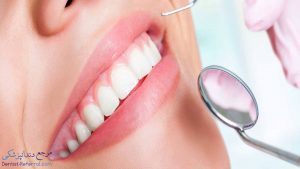 دندانپزشک متخصص کورتاژ لثه در شیراز به همراه آدرس و تلفن