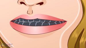 چگونه از سیاه شدن دندان ها جلوگیری کنیم ؟راه حل قطعی رفع سیاه شدن دندان