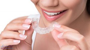 اسپلینت دندان شیراز | درمان دندان لق در شیراز
