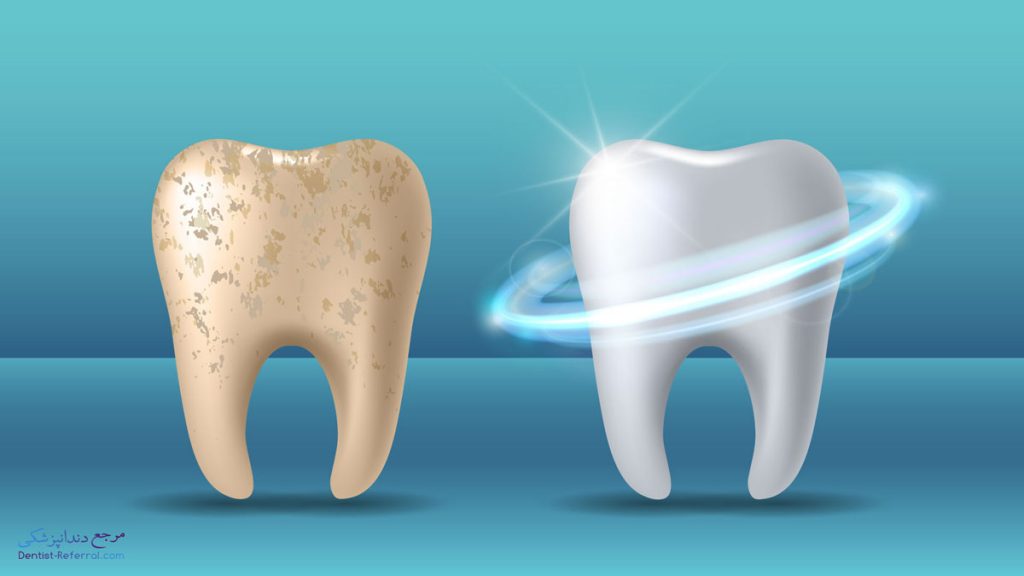راه های کاربردی برای تقویت مینای دندان