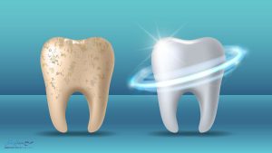 راه های کاربردی برای تقویت مینای دندان