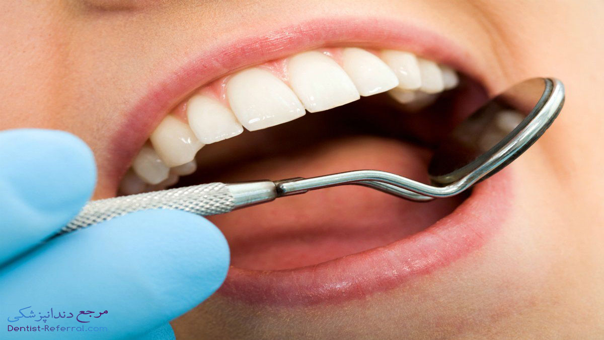 روش های درمان پوسیدگی دندان در خانه