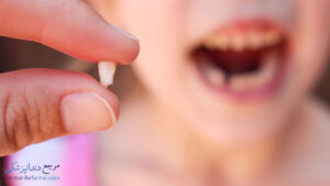 تروما دندان چیست و چگونه به وجود می آید؟
