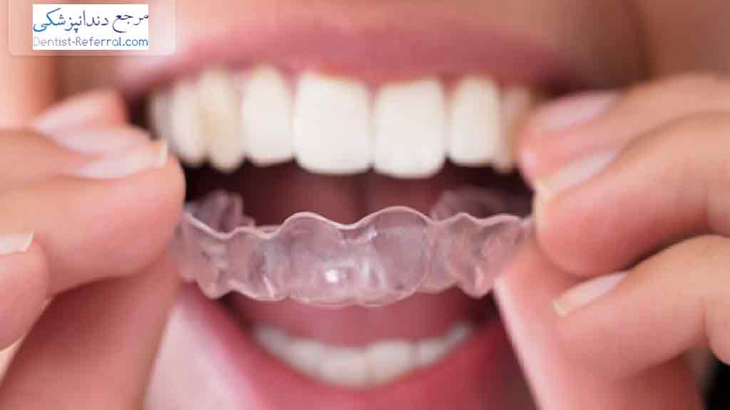 تاثیر دندان قروچه بر سلامت دندان