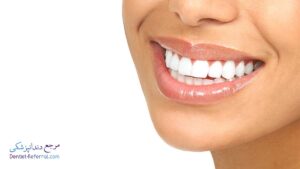بهترین دندانپزشک کامپوزیت دندان در فرهنگ شهر شیراز