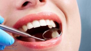 بهترین دندانپزشک کامپوزیت دندان در پاسداران شیراز