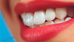بهترین دندانپزشک زیبایی در وکلا شیراز