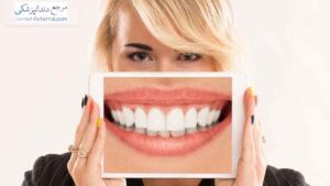 دندانپزشک لمینت دندان اقساطی در شیراز