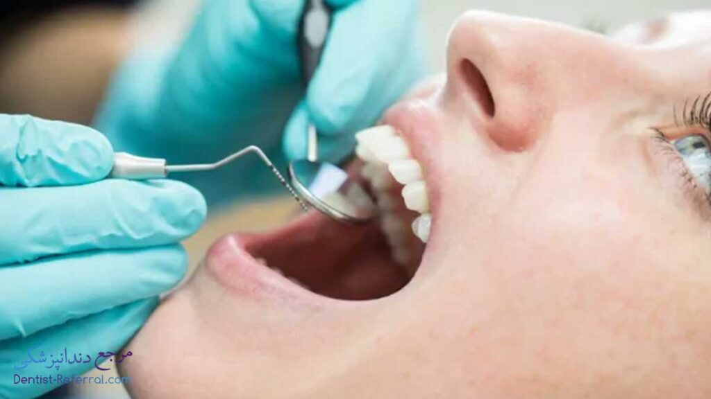 بهترین دندانپزشک کامپوزیت دندان در بلوار رحمت شیراز