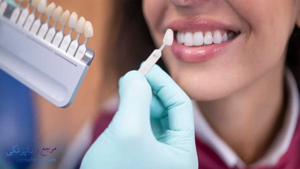 دندانپزشک کامپوزیت دندان در بلوار پاسارگاد شیراز