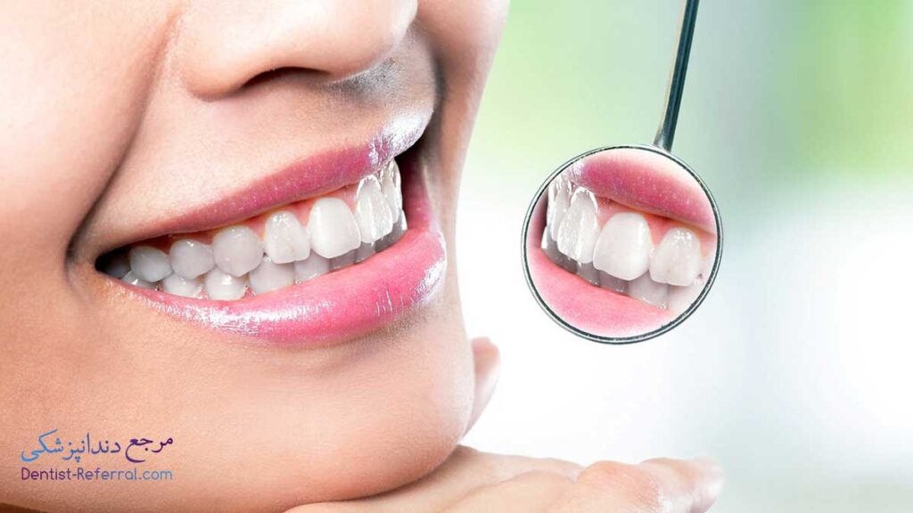 دندانپزشک کامپوزیت دندان در زرگری شیراز