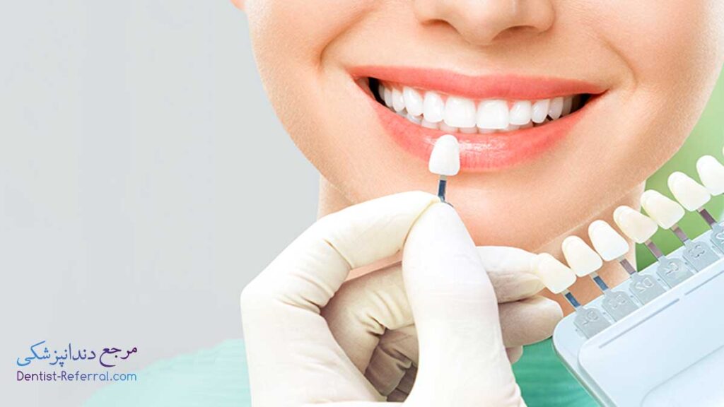 دندانپزشک کامپوزیت دندان در زرگری شیراز