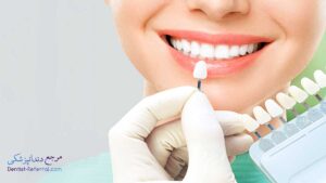 بهترین دندانپزشک کامپوزیت دندان در زرگری شیراز
