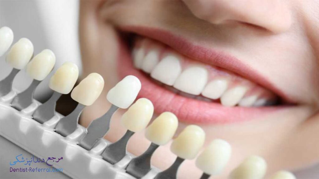 دندانپزشک کامپوزیت دندان در بلوار زند شیراز