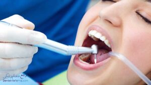 بهترین دندانپزشک لمینت دندان در معالی آباد شیراز