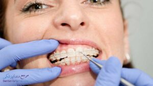بهترین دندانپزشک متخصص ارتودنسی دندان در پاسداران شیراز
