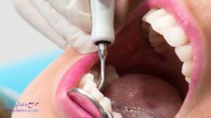 دندانپزشک متخصص درمان ریشه دندان در قصردشت شیراز