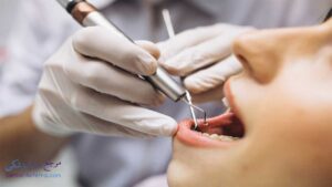 بهترین دندانپزشک متخصص درمان ریشه دندان در تاچارا شیراز