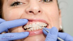 بهترین دندانپزشک متخصص ارتودنسی دندان در دانشجو شیراز