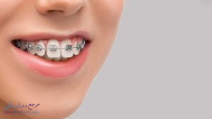 بهترین دندانپزشک متخصص ارتودنسی دندان در قصردشت شیراز