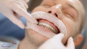 بهترین دندانپزشک متخصص ارتودنسی دندان در مشیر فاطمی شیراز