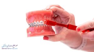 بهترین دندانپزشک متخصص ارتودنسی دندان در زرگری شیراز